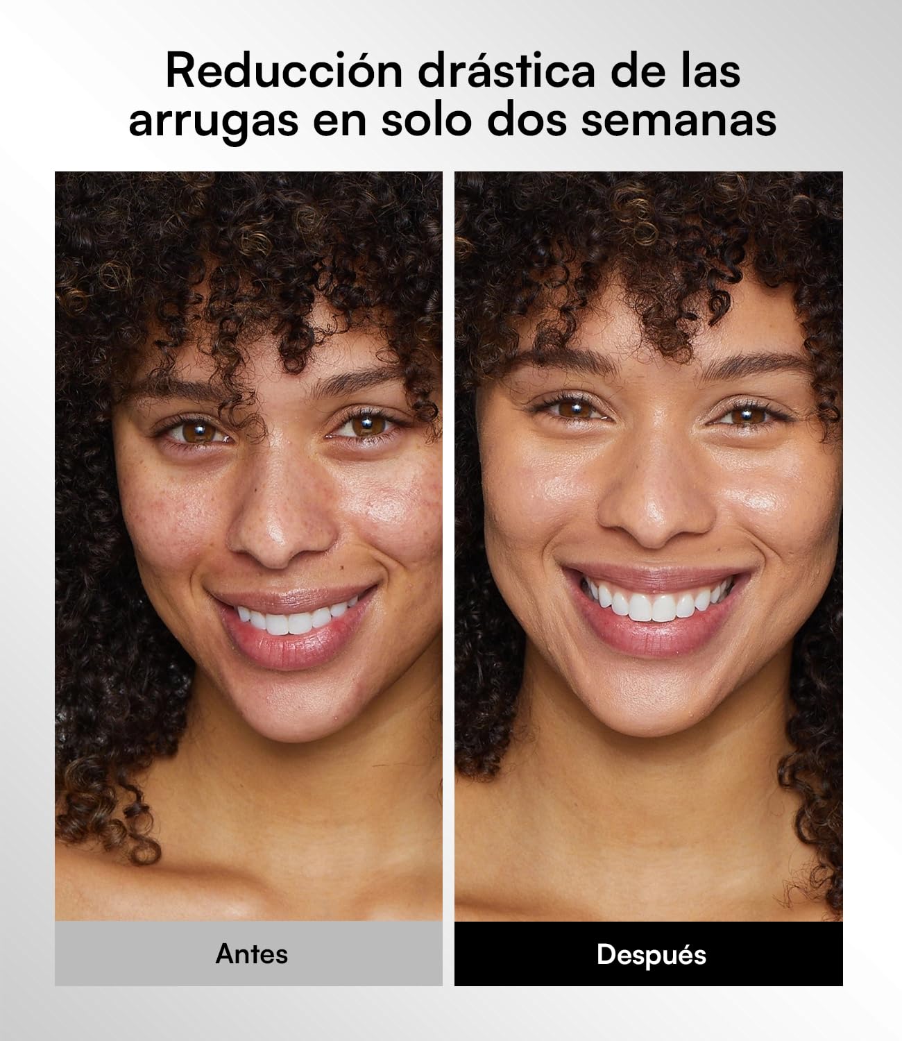 Máscara Facial LED Inalámbrica INIA Glow, Máscara de Terapia de Luz Roja Aprobada por la FDA con Luz Roja Cercana al Infrarrojo (NIR), Diseño Recargable y Ergonómico para el Hogar y Viajes, Rosa