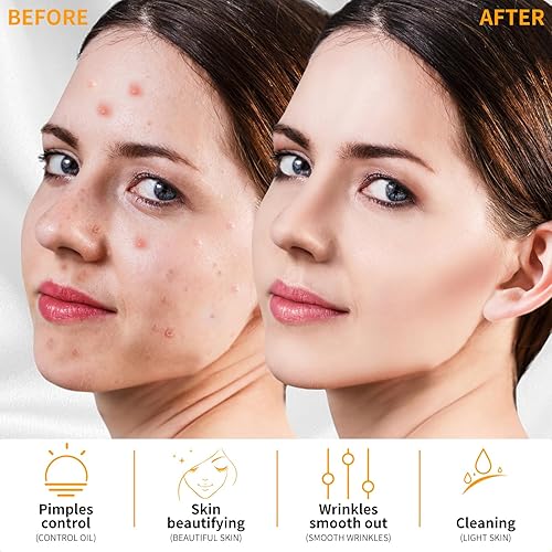 Miniatura 4 de MYSWEETY Varita de electrodo 4 en 1, portátil, de alta frecuencia facial, con 4 tubos diferentes