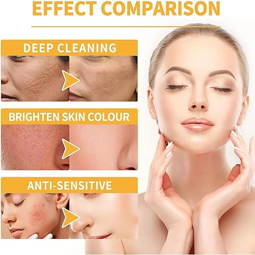 Miniatura 3 de Máscara exfoliante de té negro, mascarilla limpiadora de puntos negros, mascarilla facial de limpieza profunda, antienvejecimiento de puntos negros,