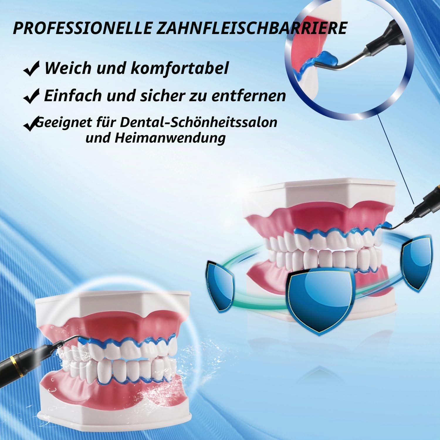 Luckin Smile 10PCS 3ML Zahnfleischschutz-Gel, Zahnfleischschutz-Gel für Zahnaufhellung, geeignet für Zahnarztpraxis, Zahnarzt und Hausgebrauch