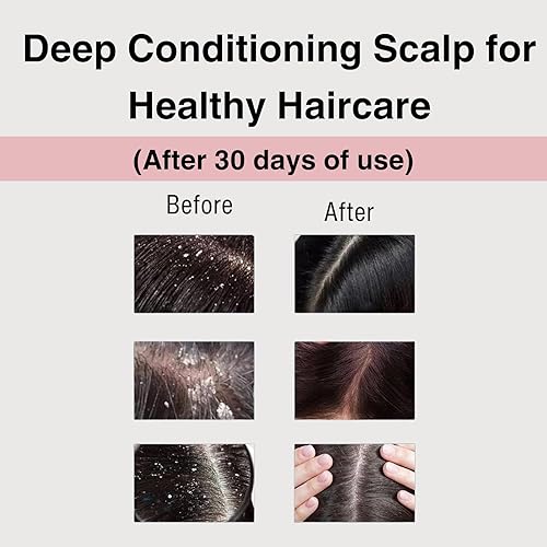 Miniatura 2 de Moist Diane Perfect Beauty Extra Vital Tratamiento 15.2 Fl Oz15.2 fl oz