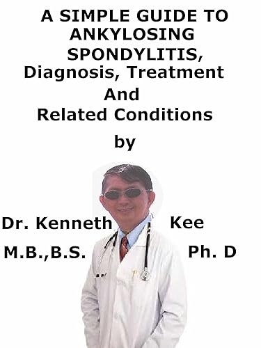 A Simple Guide To Ankylosing Spondylitis, Diagnosis, Treatment And Related