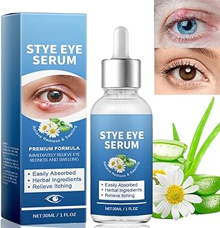 Stye Eye Treatment,Under Eye Serum,Natural Stye Eye Serum for Styes,Eye Serum for Dark Circles,Mild Lash and Eye Cleanser,Eye Bags Remover,Eye Care Products,Restore Healthier Eye Skin,Eyes Serum