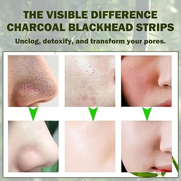 20 Pcs Blackhead Remover Nose Strips – Deep Cleansing Charcoal Pore Strips for Women & Men, Removes Blackheads, Refines Pore Appearance, Oil Control for All Skin Types