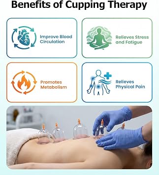 Cupping Therapy Set with 24 Cups: Vacuum Kit with Hand Pump | U-Shaped Cups with Gua Sha Board and Acupoint Chart for Women and Men - Helps Ease Neck and Back Muscle Soreness