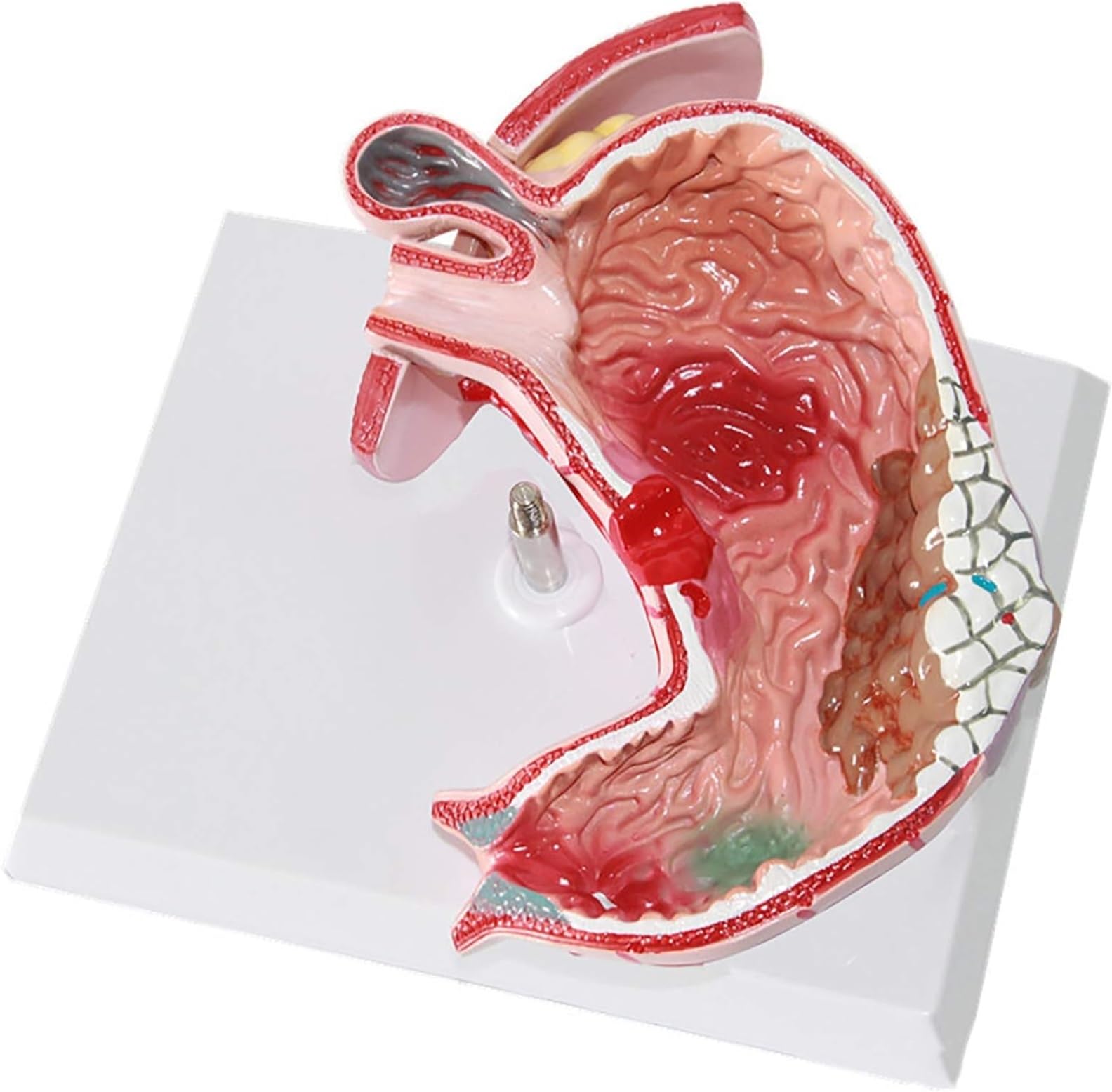 Model Człowieka Model Anatomiczny Ludzkiego Układu Trawiennego Żołądka Dla Lekarzy Medyczne Narzędzia Dydaktyczne Anatomia