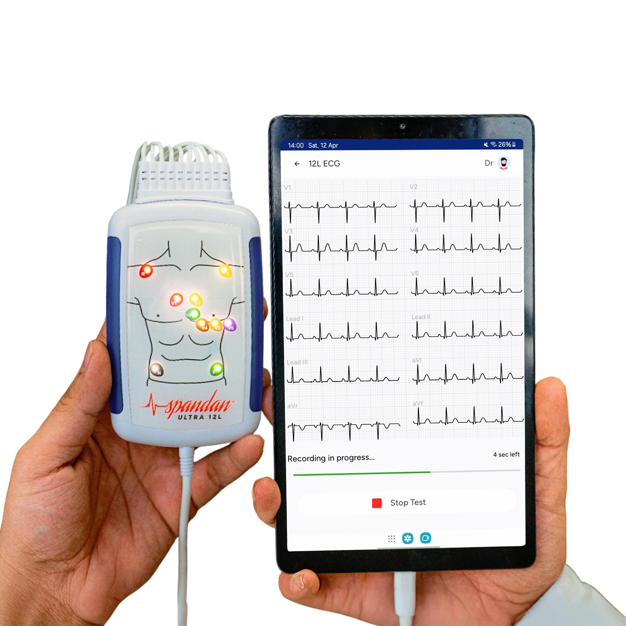 Spandan Ultra 12L | 12-Lead Portable ECG Machine for Doctors | Hospital Grade ECG | 12L Multichannel ECG | 12-Lead ECG | 12 Channel ECG-picture-15