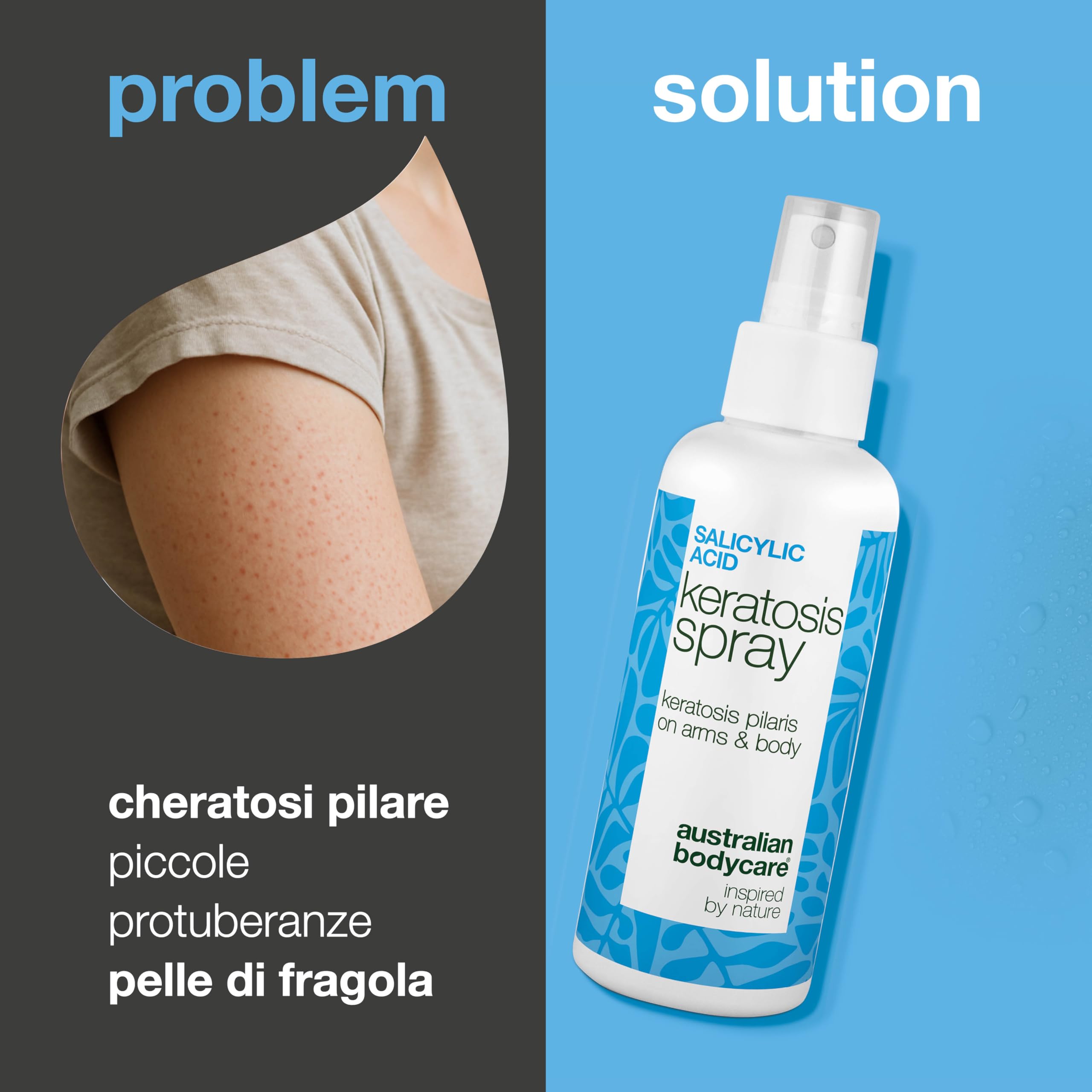 Spray per Keratosis Pilaris – contro pelle di pollo, ruvida e con brufoletti – con acido salicilico, acido glicolico, glicerina e pantenolo