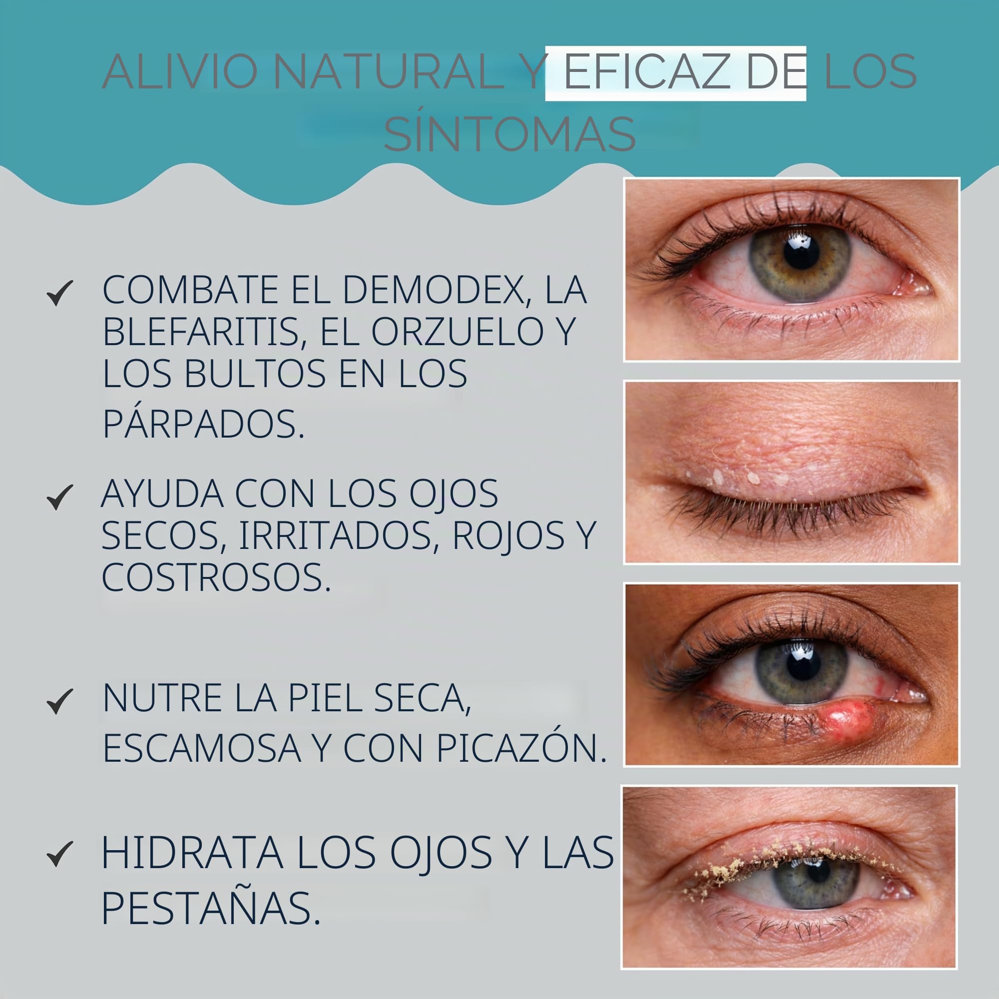 NOVEHA Demodex - Limpiador espumoso extra fuerte, con extracto de aceite de árbol de té, 100 ml