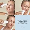 NuFACE FDA Cleared Effective Lip & Eye Attachment for TRINITY+ Microcurrent Facial Device - At Home Eye & Smile Lines Treatment to Tighten Hard-to-Reach Areas Around Mouth and Eyes