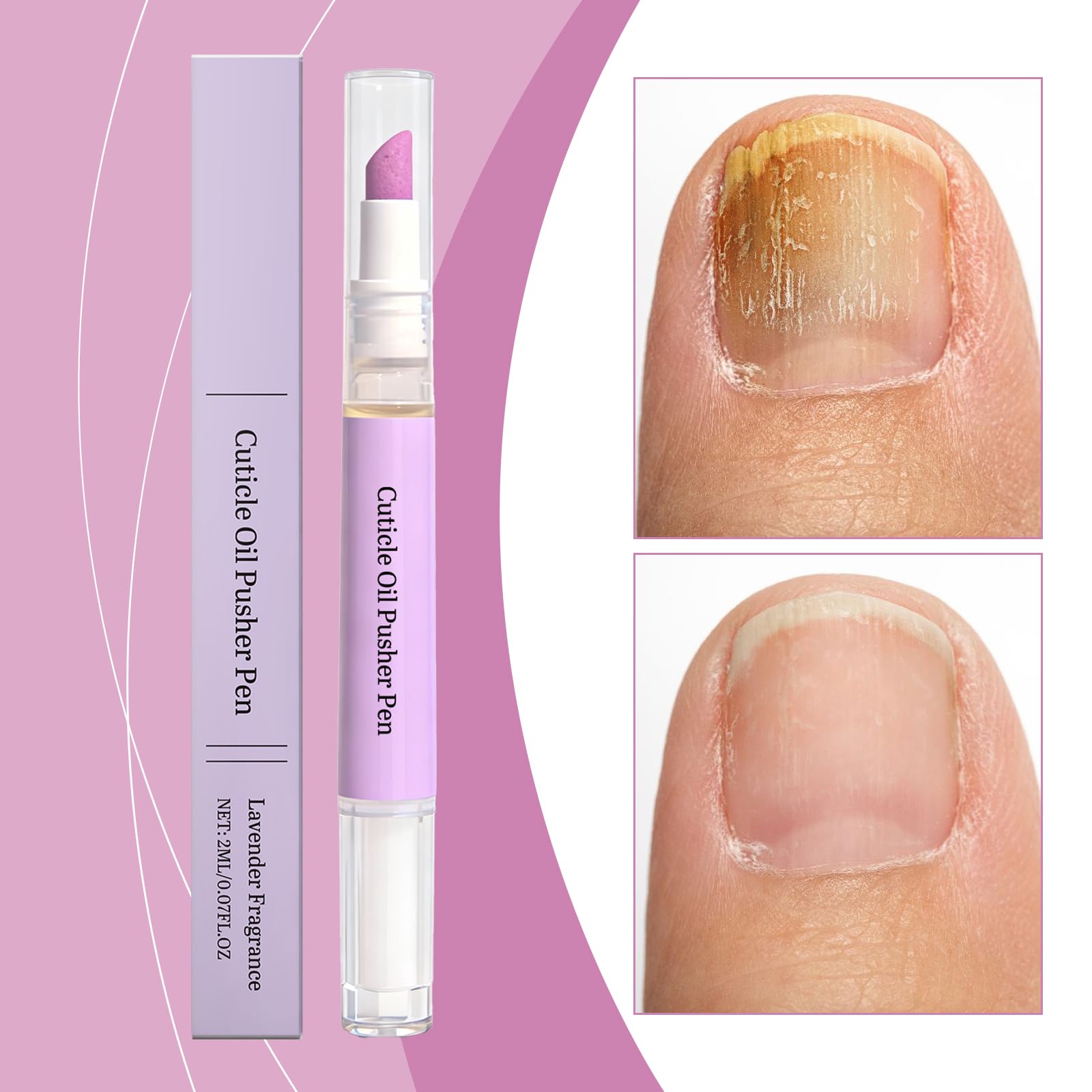 Rimuovi cuticole liquido, penna olio cuticole 2 in 1, penna spingi cuticole, Nail Care, penna a olio spingi cuticole, cura per la riparazione delle unghie secche e danneggiate (1 pezzo)