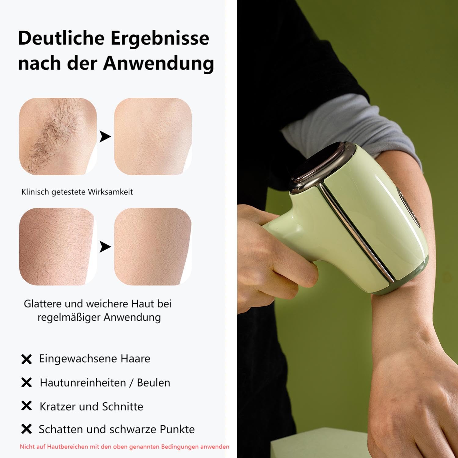 IPL Haarentfernungsgerät schmerzfrei für Damen (Beine, Gesicht, Bikini) | Eispunkt-Kühltechnologie für Arme und Achseln als perfekte Vorbereitung auf den Sommerurlaub