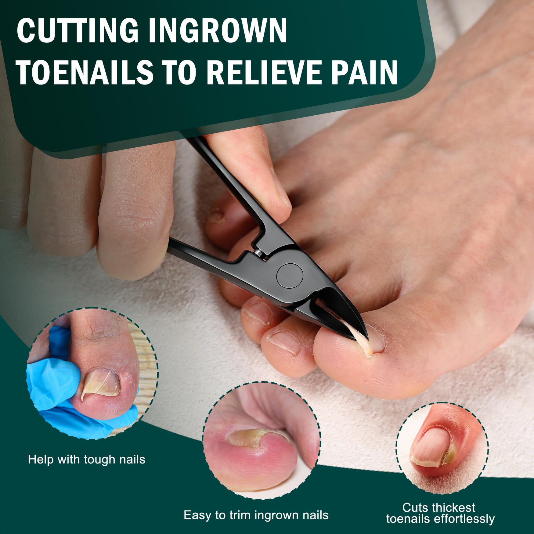 FVION Precisione Tronchesino Unghie Piedi Professionale, Tronchese Per Unghie Spesse Incarnite in Acciaio Tagliaunghie Manicure e Pedicure