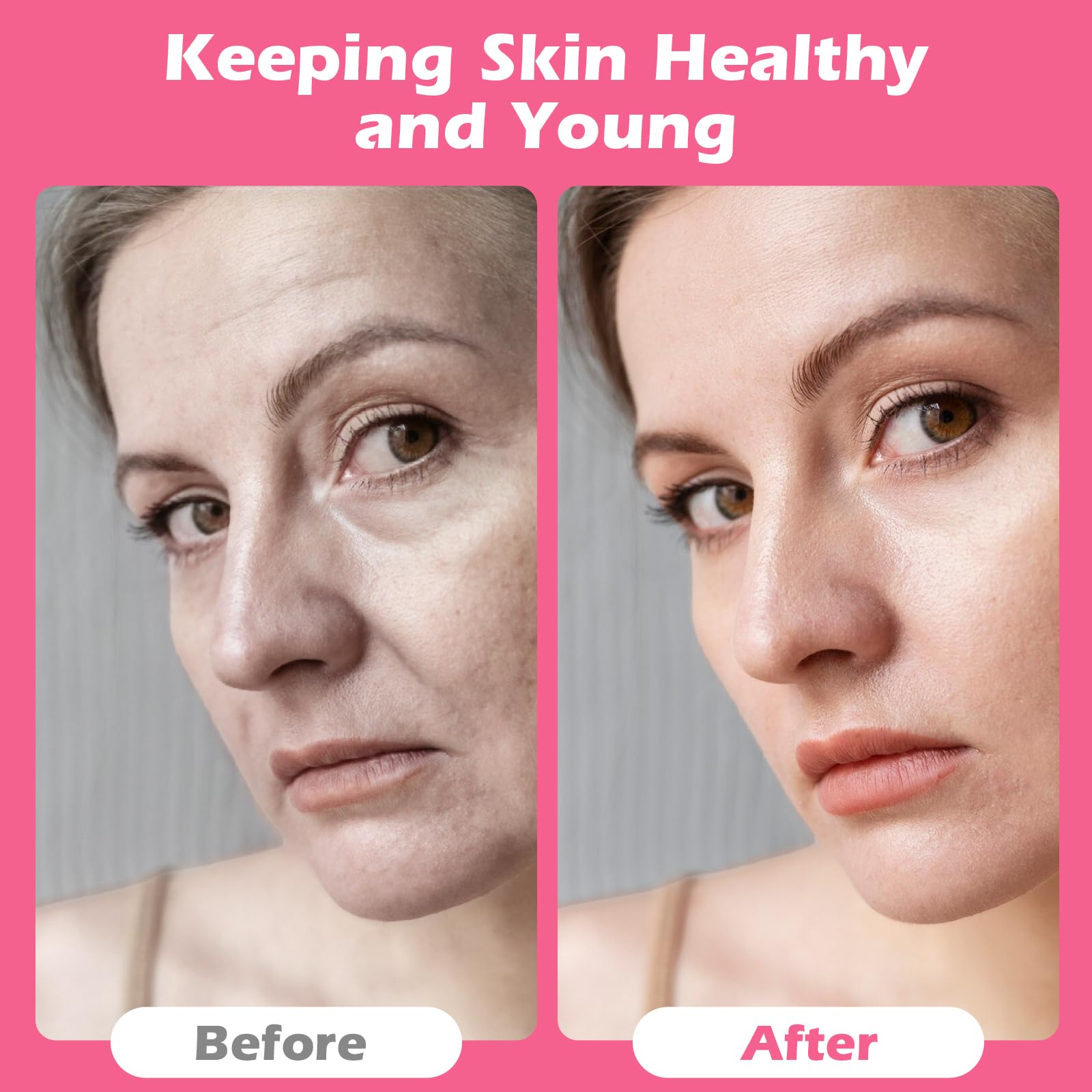 4 Rollos de Cintas Kinesiologicas Faciales y 1 Par de Tijeras,Parche Facial Antiarrugas 2.5cm×5m,Tiras de Lifting Facial,Multifuncional y Alta Elasticidad,Esparadrapo Facial Antiarrugas