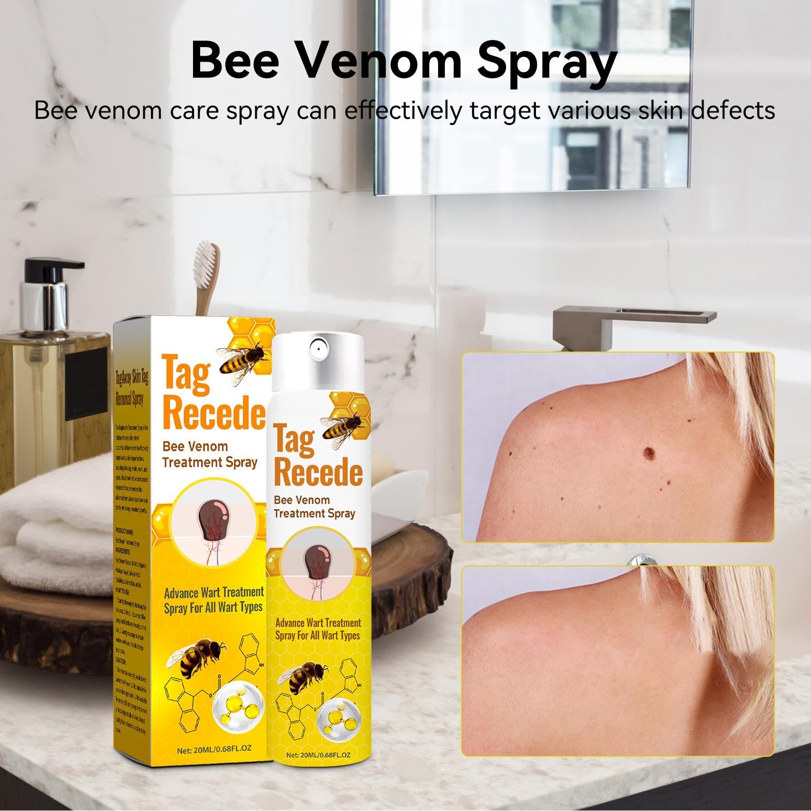 Spray De Abeja, 2 Piezas Spray De Eliminar Verrugas, Bee Venoms TheatmentSpray, Sprayde Veneno DeAbeja Con Extracto DeAbeja, Para Quita Verrugas Cuello Y Cara