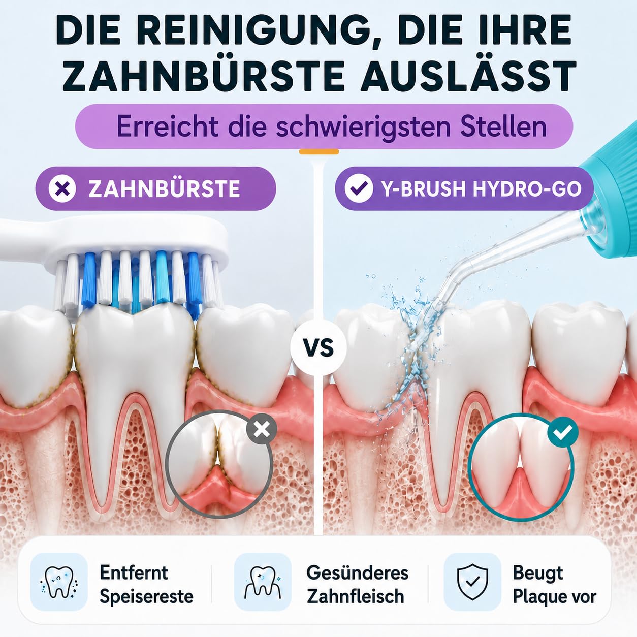 Hydro-Go Zahnzwischenraumreiniger, kabellos, mit integriertem Zungenreiniger, tragbar, wasserdicht, 1 Monat Laufzeit | Biotech Dental, Nr. 1 des Implantats | kabellos, kompakt | 100 ml Tank | Zungenreiniger inklusive | Akku | USB-C