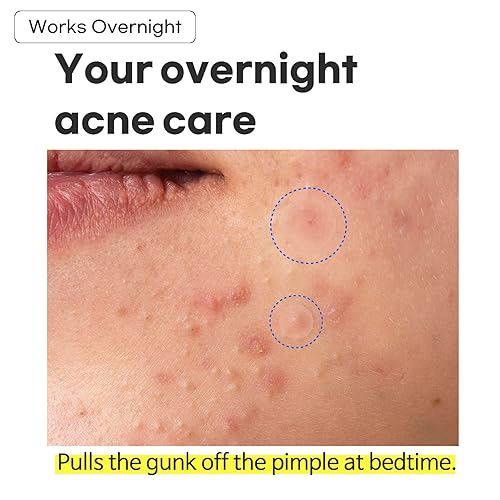 Miniatura 7 de TIAM Surprise B Parche (120 unidades, paquete de 5), parche hidrocoloide para acné