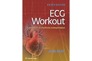 ECG Workout: Improve Your Arrhythmia Interpretation Skill Instantly