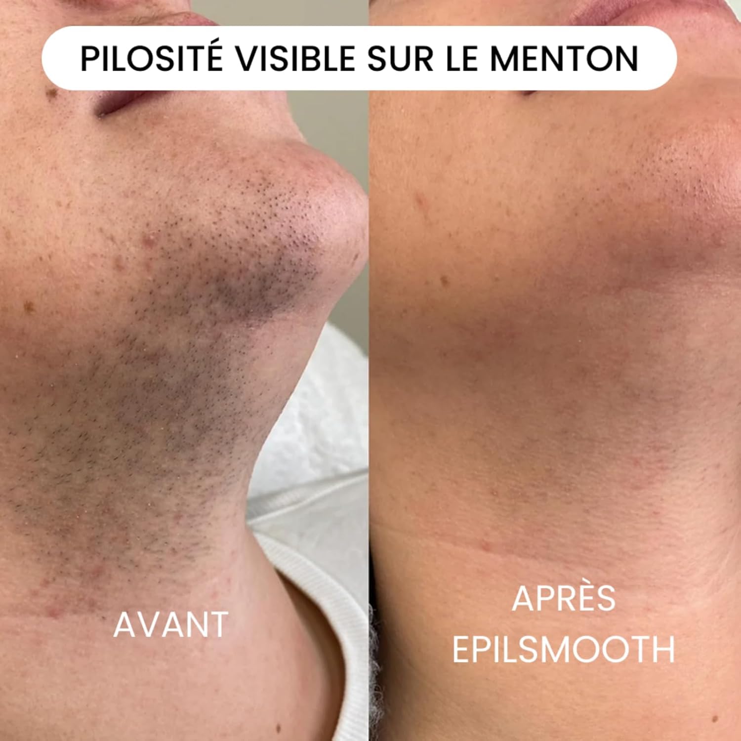 klyne EpilSmooth Pro Epilateur Electrique Femme Portable, avec Lumière LED Intégrée et Câble USB, pour Épilation et Efficace du Corps, Visage, Jambes et Bras