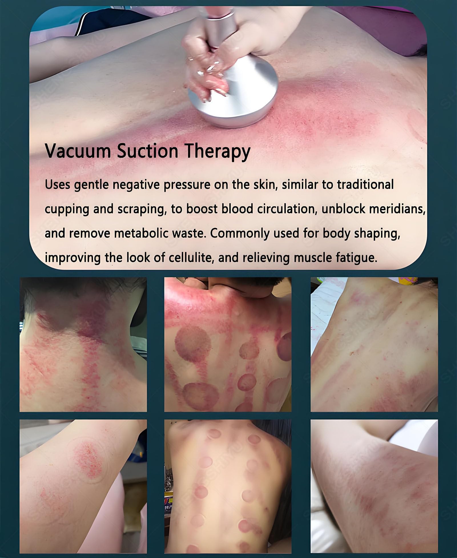 Máquina de Cavitación Adelgazante 9 en 1,Masajeador Multipolar de Radiofrecuencia para Estiramiento de Piel,Dispositivo de Reducción Vacío para Todo El Cuerpo,vacuvia Maquina Celulitis A