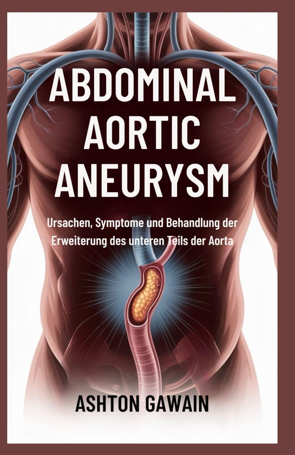 Abdominal Aortic Aneurysm: Ursachen, Symptome und Behandlung der Erweiterung des unteren Teils der Aorta