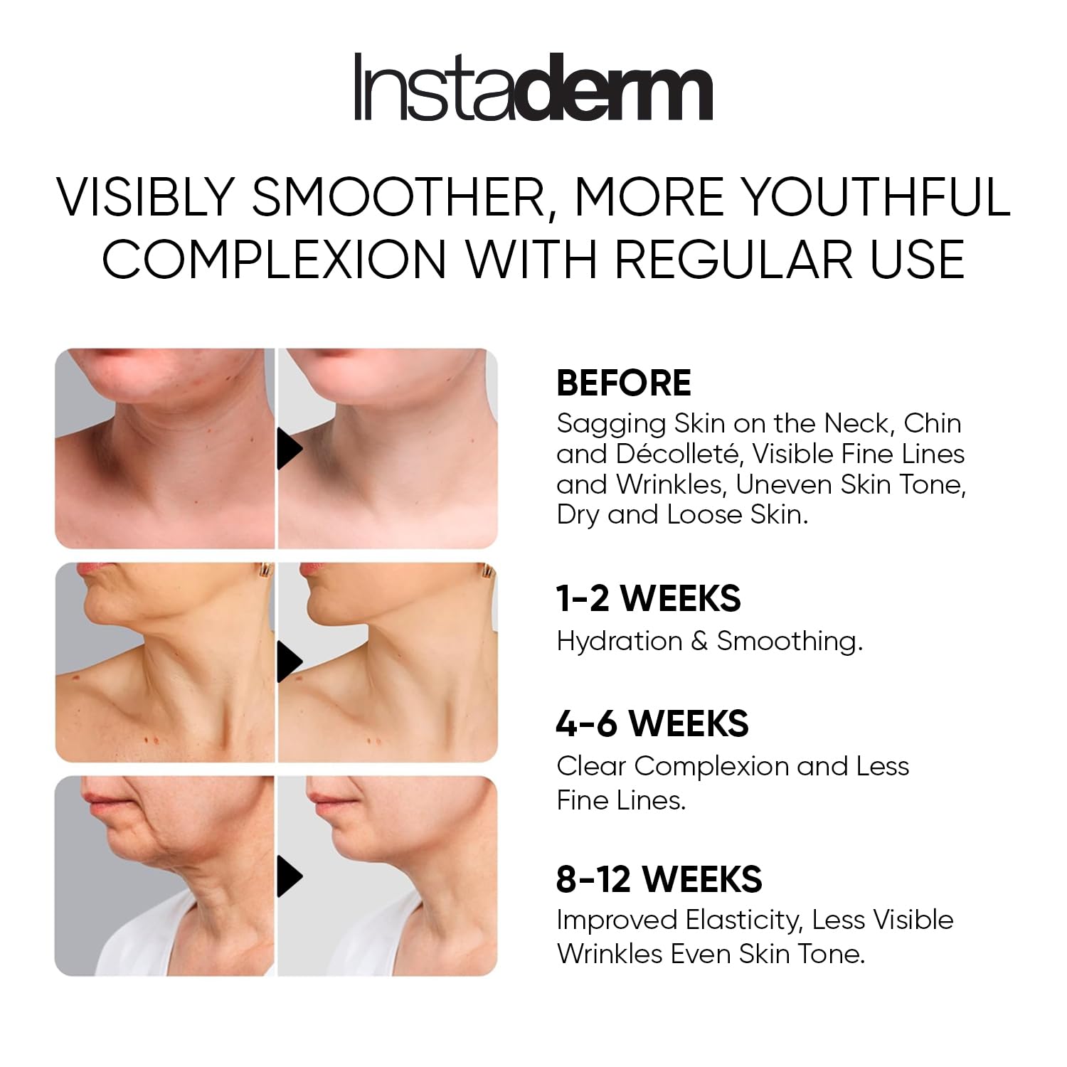 Neck and Décolleté Firming Craem, Tightening & Lifting Treatment for Crepey Wrinkles - Image 3