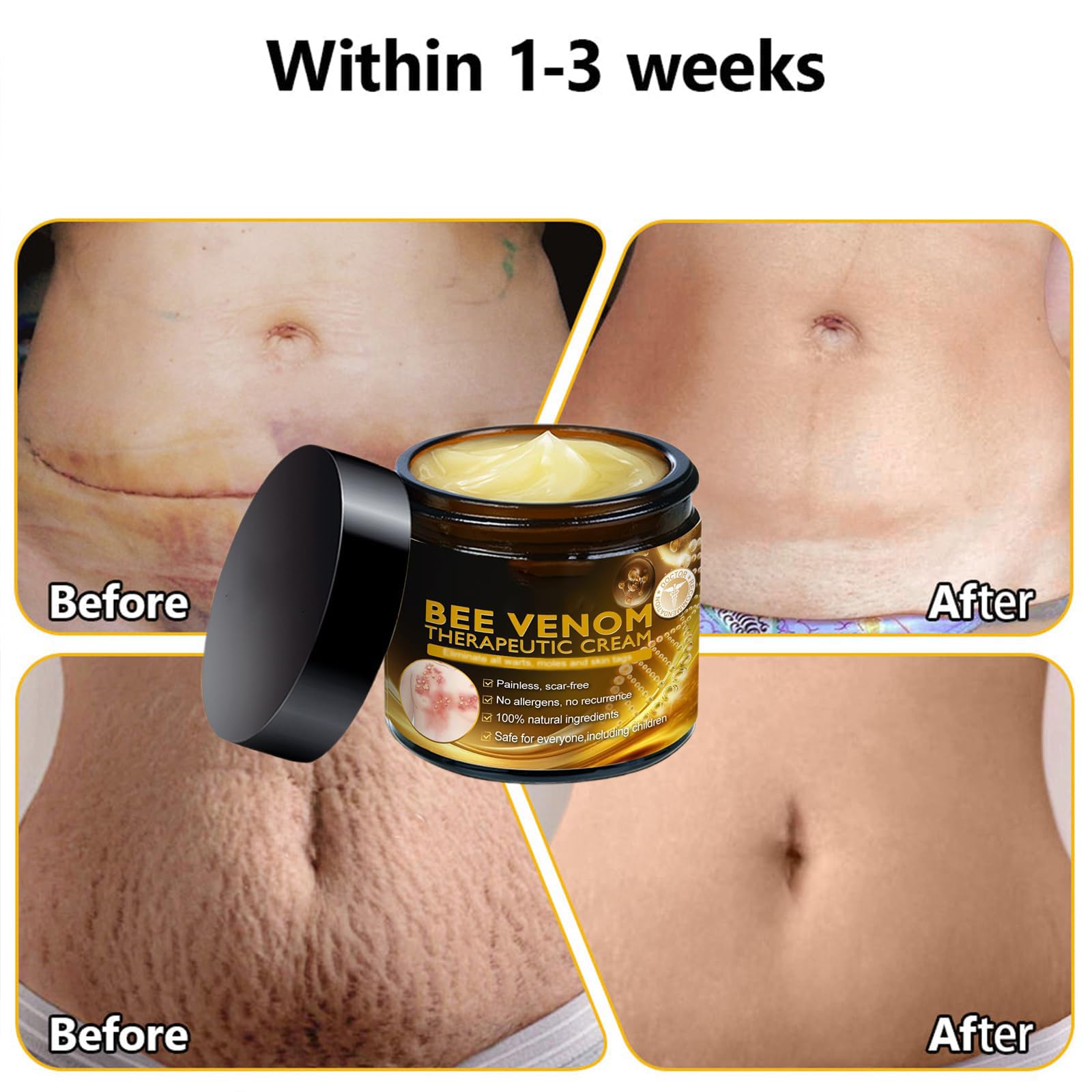 DEJIN Bee Venom Skin Treatment Cream: Professional Bee Venom Repair & Moisturizing Cream for All Skin Types - Hydrating Formula - Image 4