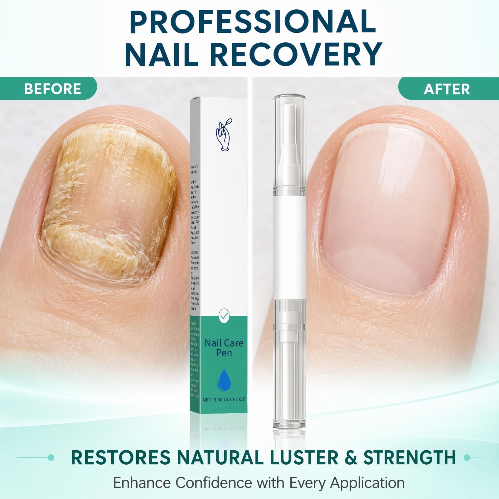 Nail Care Pen, 2 Stück Nagelpilz Stift zur Nagelpflege Fingernägel & Fußnägel, Nagelpilz Pen mit Teebaumöl & Aloe Vera, Schnelle Absorption Nägel Nähren