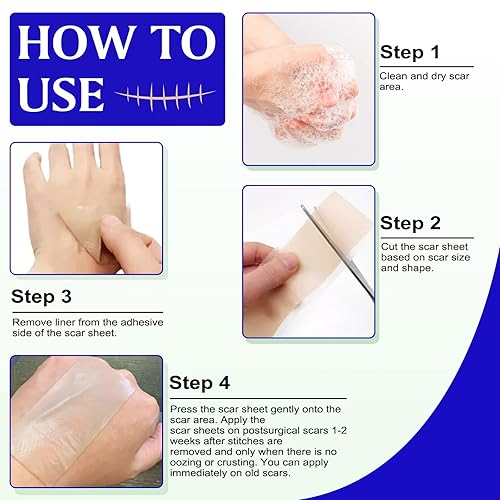 Miniatura 6 de Hojas de silicona para cicatrices, 20 hojas profesionales reutilizables de silicona para eliminación de cicatrices causadas por cesáreas, cirugía,