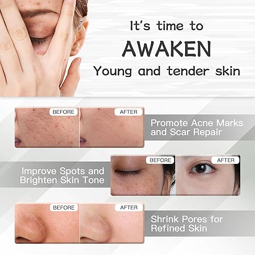 Miniatura 4 de Bolígrafo profesional inalámbrico de microagujas con 2 piezas de máquina de microagujas inalámbrica ajustable con 20 cartuchos de repuesto para uso