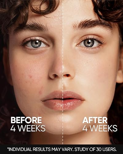 Miniatura 6 de SKINTIFIC Suero renovador de la piel con retinol para cara, cuidado de manchas, control de aceite y minimización de poros, refina la textura de la