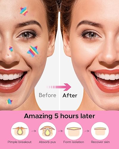 Miniatura 7 de LitBaer - Parche hidrocoloide en forma de estrella para acné con aceite de árbol de té + ácido salicílico, punto de cobertura para manchas de acné,