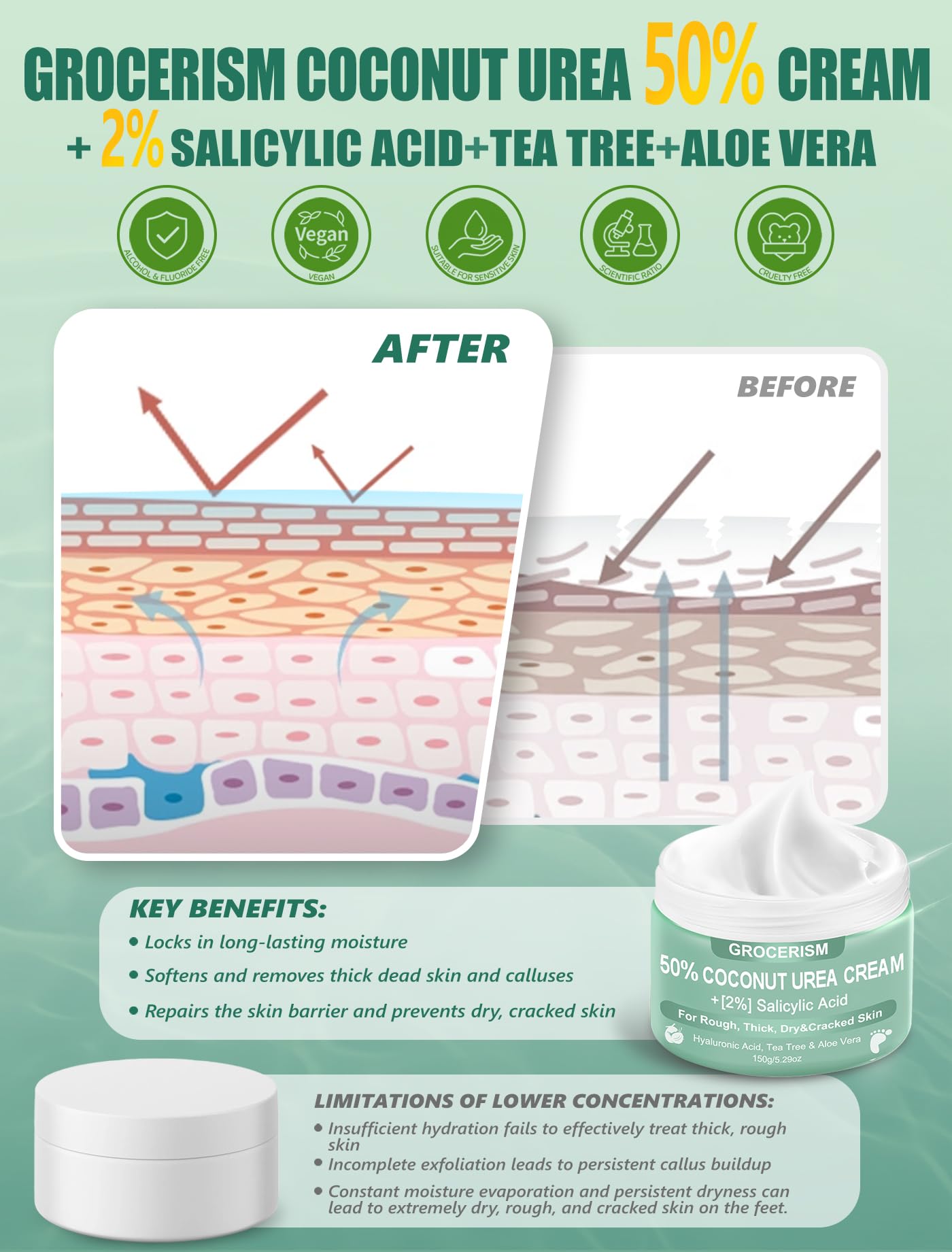 Crema Urea 50% per piedi Spessore massimo 150 grammi con cocco e 2% acido salicilico, crema piedi e mani con acido ialuronico, tea tree e aloe vera per umidificazione profonda, calli
