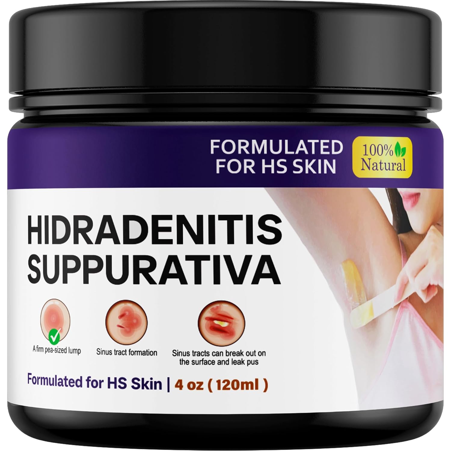 Hidradenitis Suppurativa | Fast Relief for HS Flares, Cysts, Infections, Razor Bumps, Abscesses | Natural Hidradenitis Suppurativa Cream with Propolis, Beeswax & Essential Oils – 4 oz