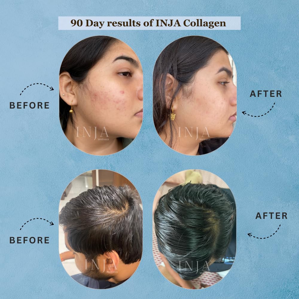 Inina fit hydrolyzed marine collagen supplement powder for women and men, Japanese collagen with vitamin C, healthy joints, muscles, muscles, skin, hair, sugar-free, gluten-free, coffee flavor, 250 grams Inina fit hydrolyzed marine collagen supplement powder for women and men, Japanese collagen with vitamin C, healthy joints, muscles, muscles, skin, hair, sugar-free, gluten-free, coffee flavor, 250 grams