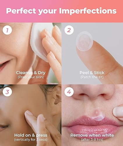 Miniatura 6 de Amazing Patch  Parche coreano Skin-Tech para espinillas invisibles, parches de acné para cara, manchas y manchas  90ea