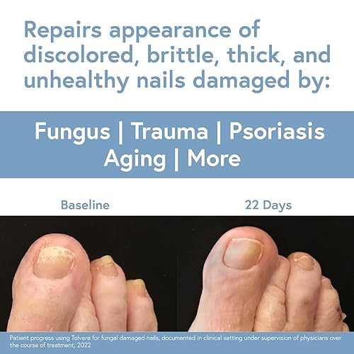 Miniatura 4 de Solución de renovación de uñas Tolvere, mejora rápidamente la apariencia de uñas descoloridas, quebradizas y agrietadas