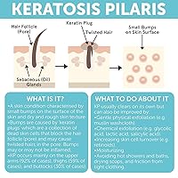 Vista 6 de KP Bump Eraser Body Set con 10% AHA Tratamiento de queratosis pilaris Loción de queratosis pilaris Exfoliante corporal Tratamiento