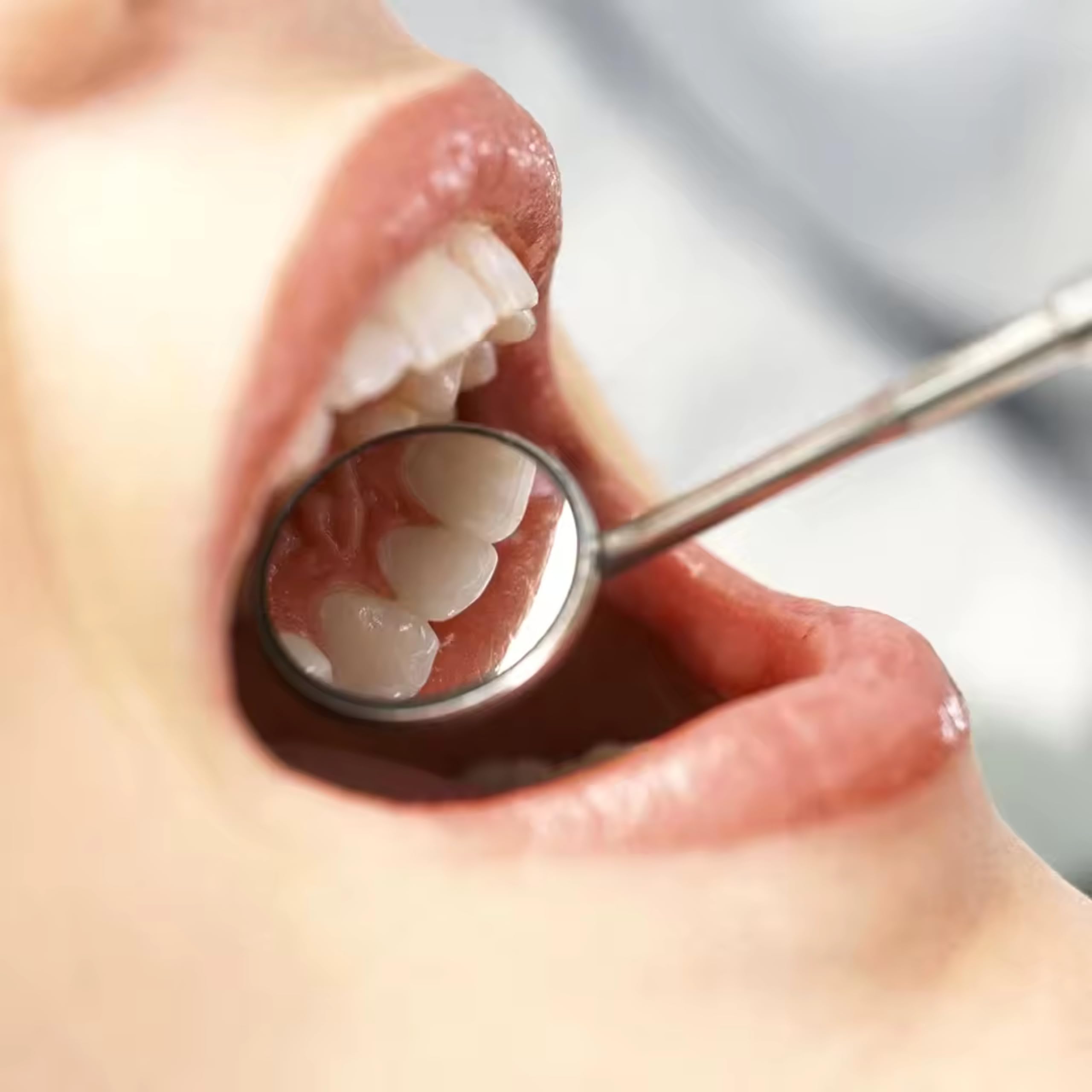 PROFESJONALNE LUSTERKO STOMATOLOGICZNE DENTYSTYCZNE POWIĘKSZAJĄCE DO ZĘBÓW