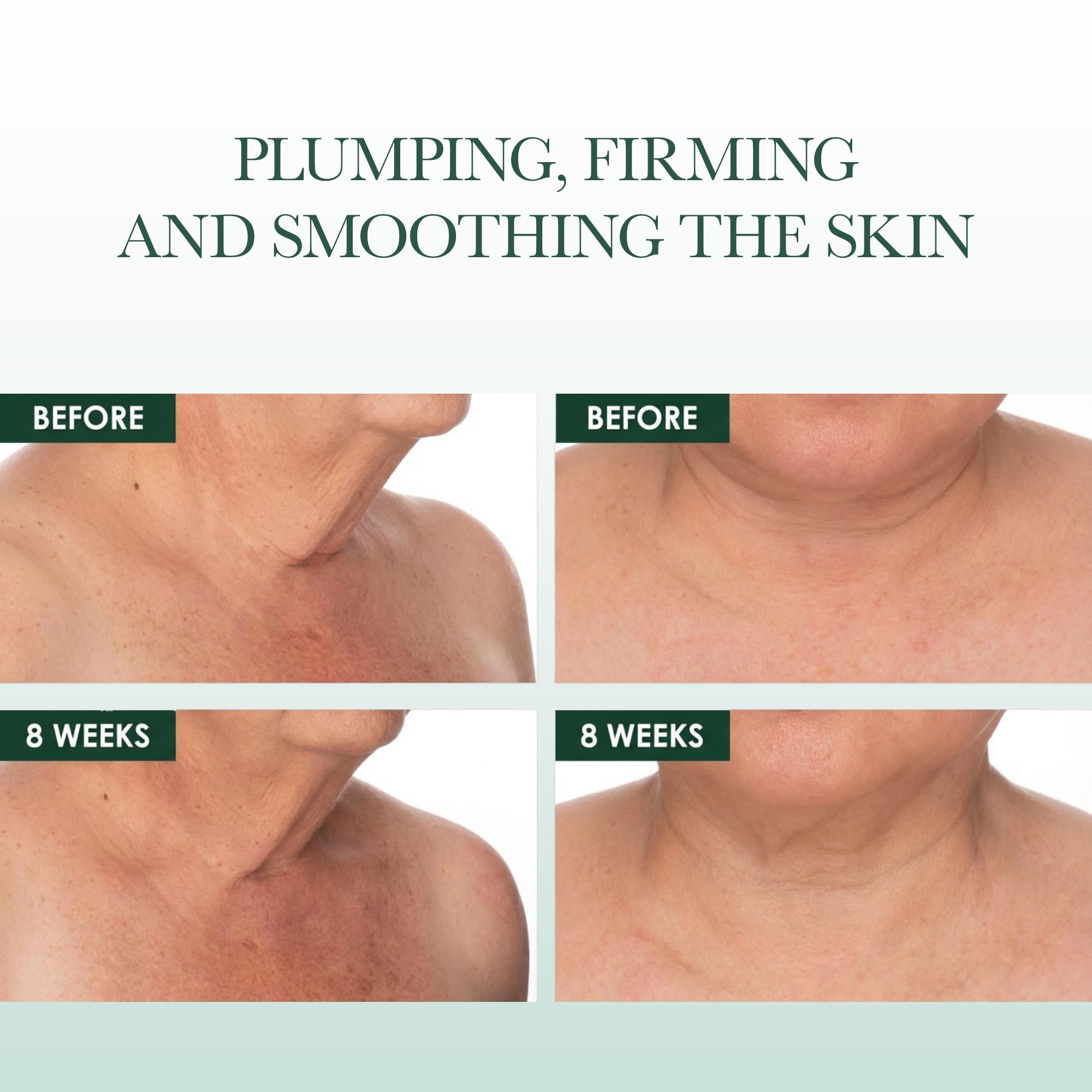 RéVive Fermitif Neck Renewal Cream - Neck and Décolletage Tightening Cream - Broad Spectrum SPF 15 Sunscreen - Anti-Aging, Reduces Fine Lines & Smooths Skin, 2.5 OZ
