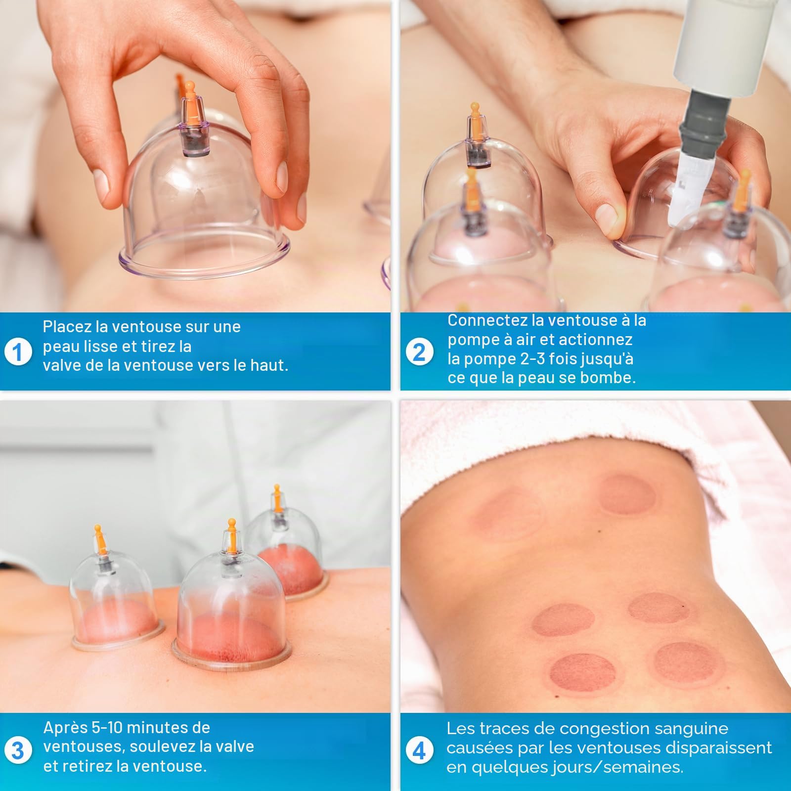 Cupping Therapy Ventouse Chinoise, 32Pcs Ventouses Set pour Visage et Corps, Professionnelles Détendre Muscles, avec des Aimants de Points D'acupression