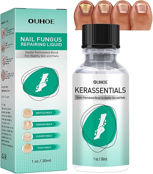 2 Pcs Solución de reparación de uñas de los pies | Líquido reparador de