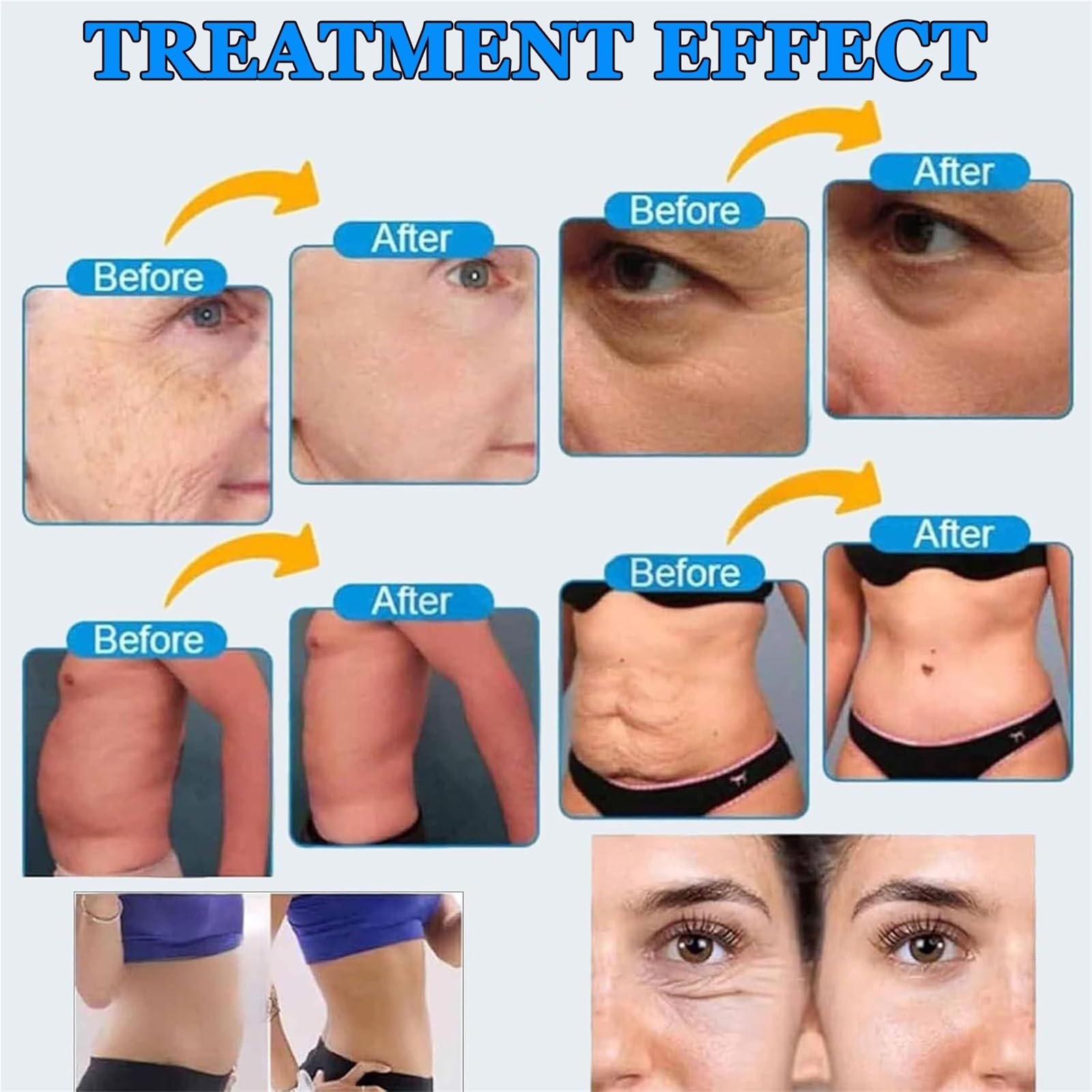 Verbessertes 7D-HIFU-Gesichtsbehandlungsgerät – Professionelles Anti-Aging-Gerät zur Gesichtskonturierung und Körperpflege für die Faltenreduzierung, geeignet für Salons, Spas und Zuhause