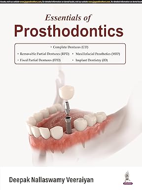 ESSENTIALS OF PROSTHODONTICS