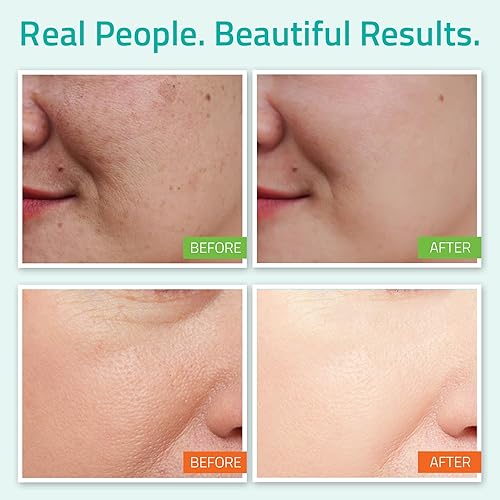 Miniatura 5 de Sistema antienvejecimiento en paquete de 3, cuidado de la piel de Yeouth suero de ácido hialurónico de grado profesional, hidratante facial