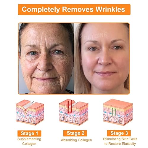 Miniatura 3 de TODAHOF Bee Venom Skin Treatment Cream para rostro y cuerpo, crema de veneno de abeja para reparación de la piel - Todo tipo de piel (1)