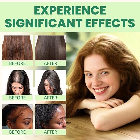 Hair Growth Serum System - Hair Serum for Thicker & Healthier Hair - With Panax Ginseng Peppermint Oil Ginger & Rosemary Extract - Stimulates Hair Follicles & Reduces Hair Loss in 8-10 Weeks