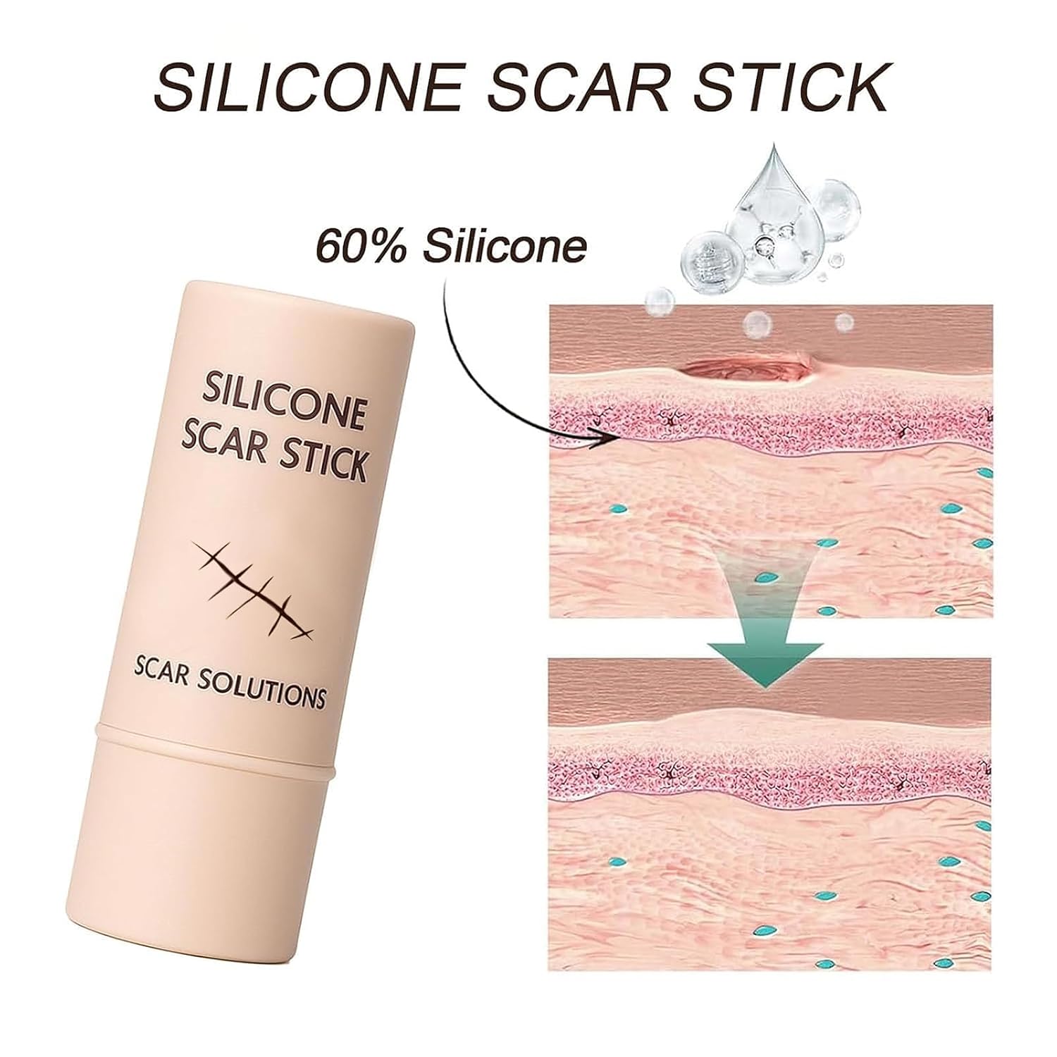 60% Silicone Scar Stick, Skin Scar Solutions for Face and Body, Stick Applicator Manual Massage, with Centella Asiatica Extracts and Vitamin E, Soothing & Gentle for All Skin Scar Types - Image 4