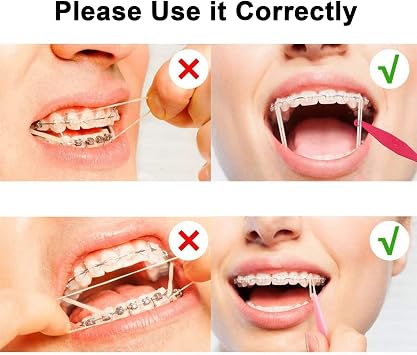 500 Pcs Orthodontic Elastic Rubber Bands, 1/4