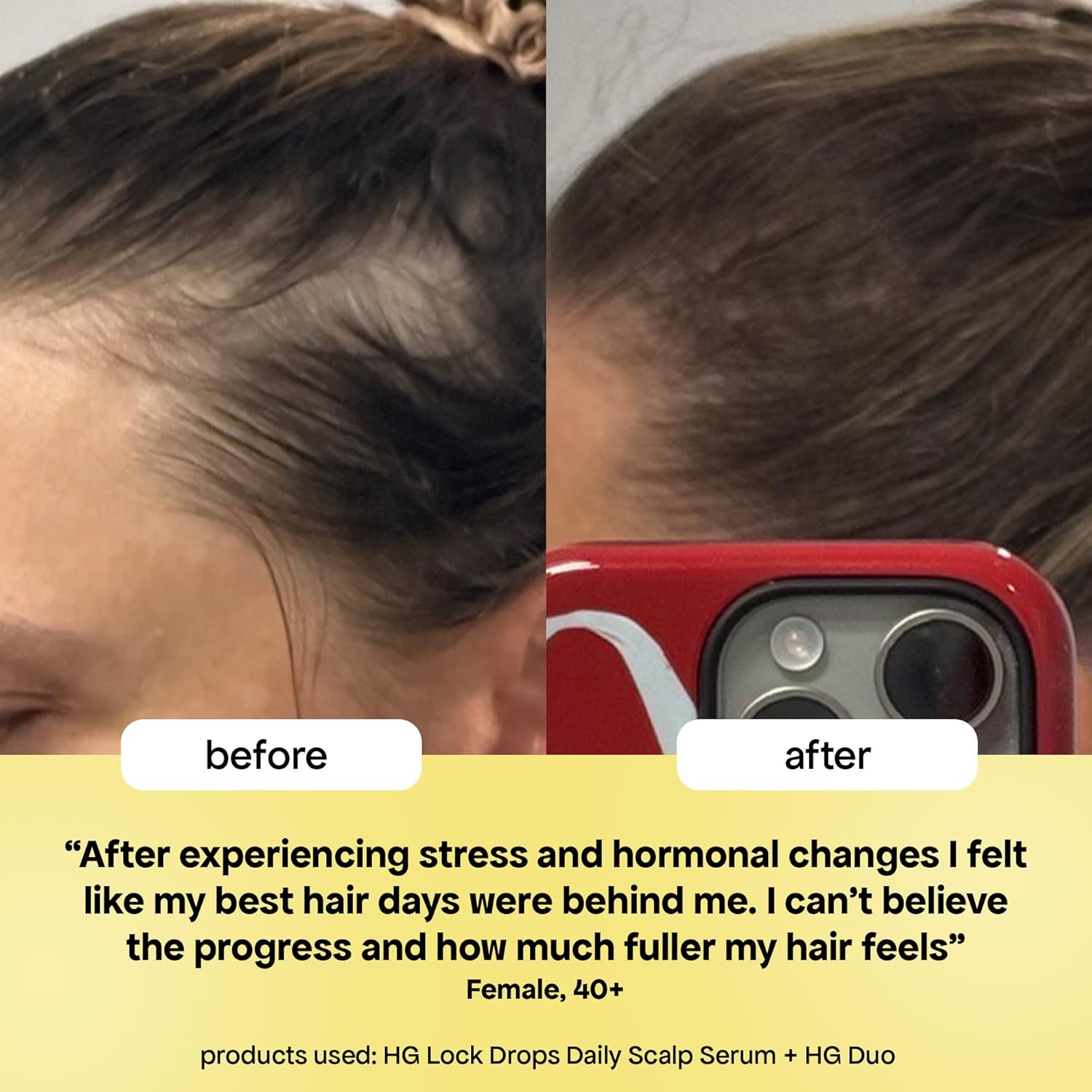 BondiBoost HG Lock Drops Daily Hair Serum for Women – Non-Greasy, Reduces Hair Thinning, Stimulates Scalp, Supports Thicker Fuller Hair – Vegan, Color-Safe, Lightweight for All Hair Types & Textures - Image 9